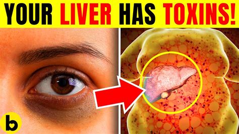 10 Warning Signs Your Liver Is Overloaded With Toxins Youtube