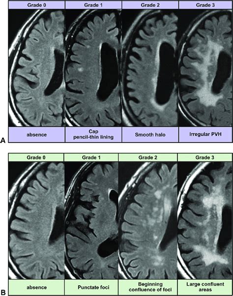 Examples Of Magnetic Resonance Imaging Of The Brain Representing The