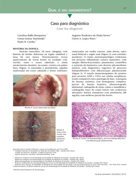 Pdf [case For Diagnosis Langerhans Cell Histiocytosis]