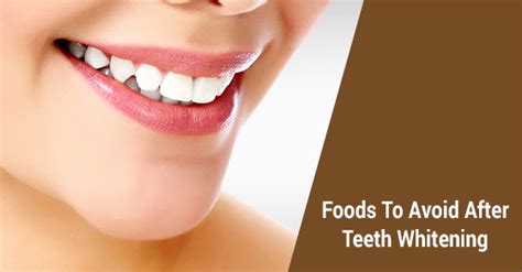 5 Foods To Avoid After A Teeth Whitening David Silberman Dds