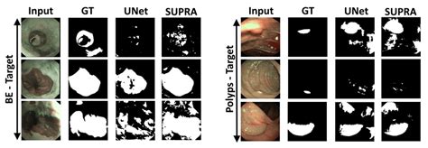 Gt Ground Truth A Qualitative Comparison Between Supra Unet Supra