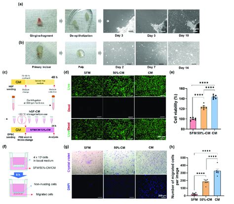 Effect Of Human Gingival Fibroblast Derived Conditioned Medium Hgf Cm