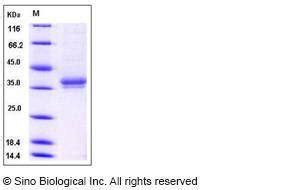 Human Recombinant IGSF11 BTIGSF Protein His Tag From HEK293 Cells VWR