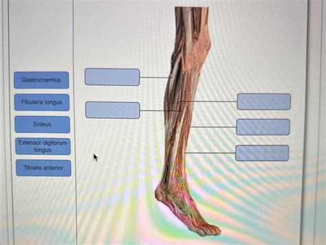 Solved Gastrocnemius Fibularis Longus Soleus Extensor