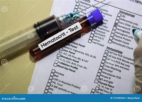 Hematocrit Test With Blood Sample Top View Isolated On Office Desk