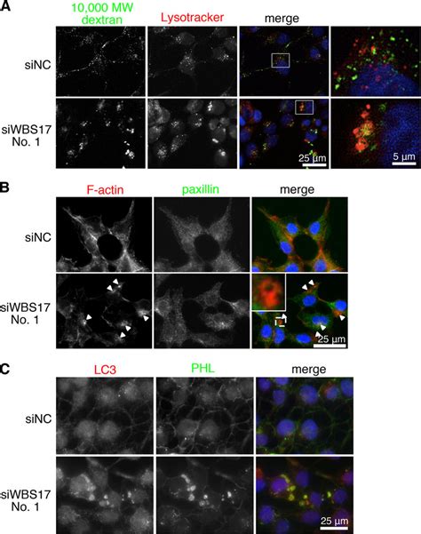 Wbscr Regulates Macropinosome Formation A Co Labeling Of The Cells