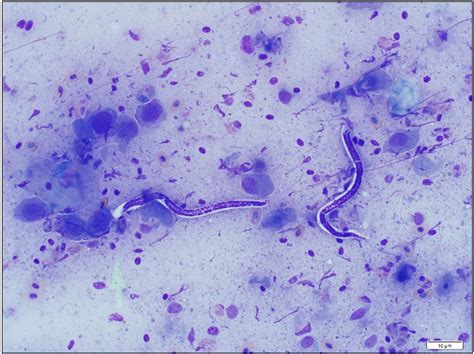 Microfilaria in a panther chameleon | Animal Health Laboratory