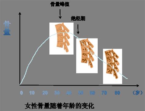 进入更年期的你，骨骼还好吗？ · 科普中国网