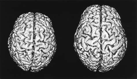 Brain Size Does Not Predict General Cognitive Ability Within Families