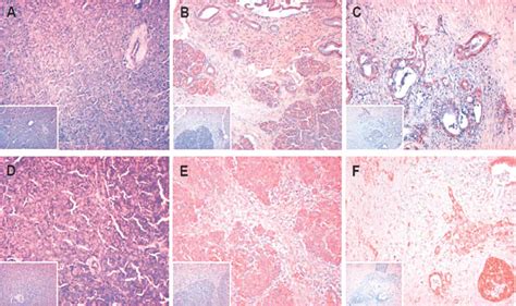 Expression And Localization Of Cxcl And Cxcr In Pancreatic Tissues