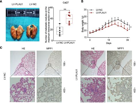 Frontiers Plau Facilitated Proliferation Invasion And Metastasis