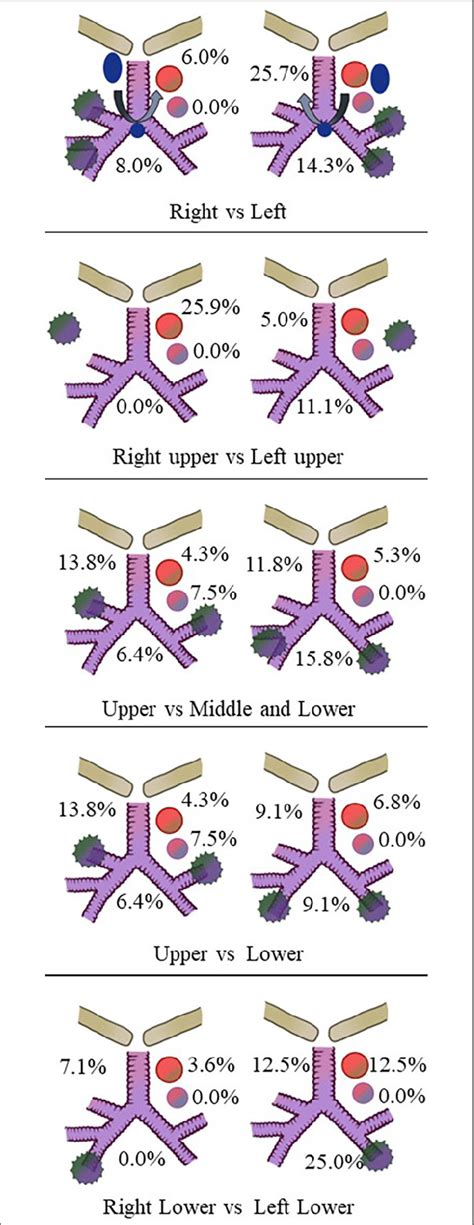 Regions Of Mediastinal Lymph Node Recurrence Levels 2 4r 2 4l 5 And