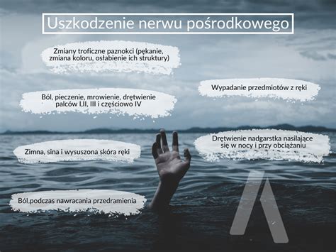 Uszkodzenie Nerwu Po Rodkowego Fizjomate