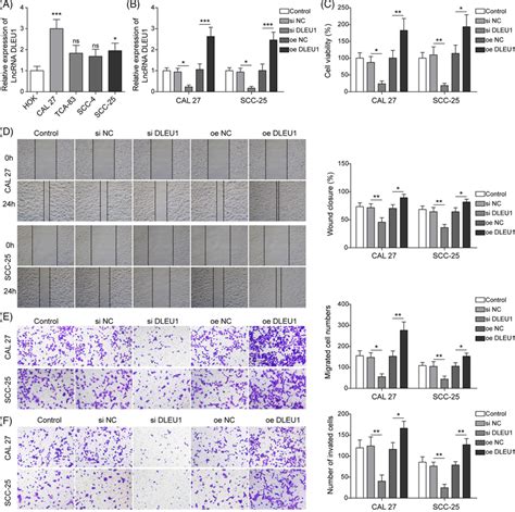 Dleu1 Promoted Proliferation Migration And Invasion In Oscc Cell