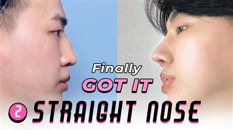 Korean Nose Job