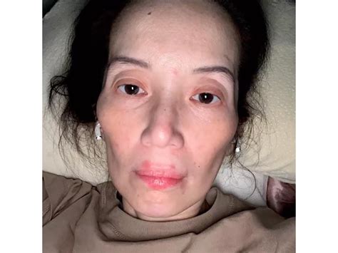 A Timeline Of Kris Aquino S Health Scares GMA Entertainment