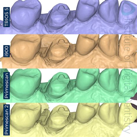 Primescan 2 Vs TRIOS 5 Medit I900 CEREC Primescan