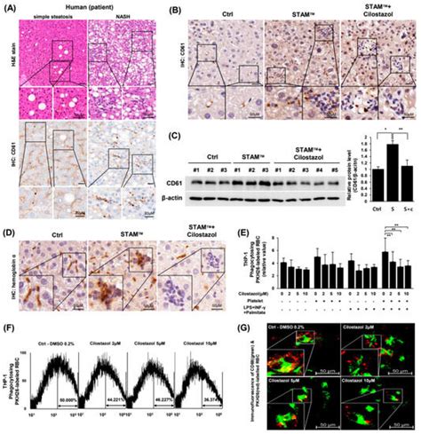 IJMS Free Full Text Pharmacological Prevention Of Ectopic