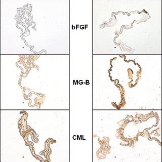 Histologic Section Of A Surgically Removed Internal Limiting Membrane