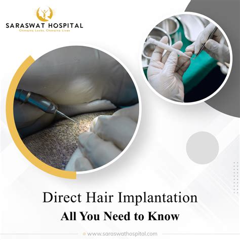 All You Need to Know About DHI Hair Transplant