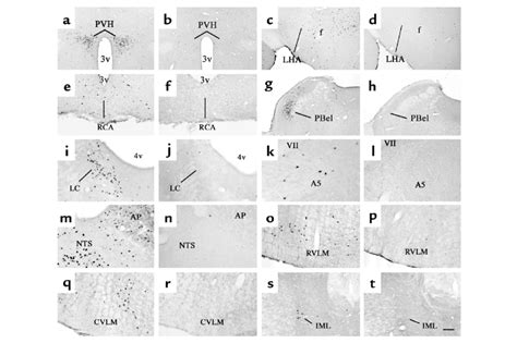 Distribution Of Iv Exn 4induced Fos Ir In The Brain A Series Of