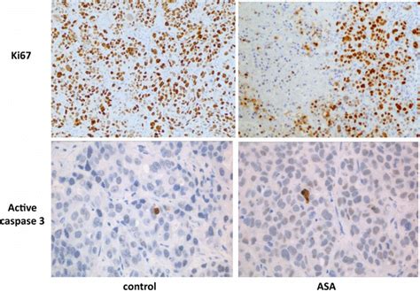 Microphotographs Showing Proliferation And Apoptosis In OE33 Derived