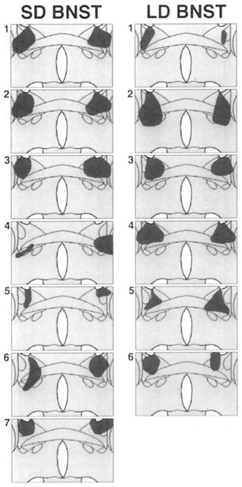 Schematic Diagrams Of Coronal Hamster Brain Sections Depicting The