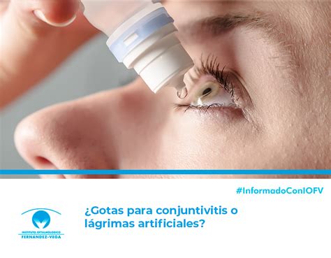 ¿gotas Para La Conjuntivitis O Lágrimas Artificiales ¿qué Utilizar