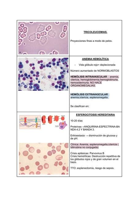 Hematolog A Anemias Leucemias Maria Jose Rivera Avila Udocz