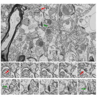 Identification Of Synapses In Serial Electron Microscopy Images