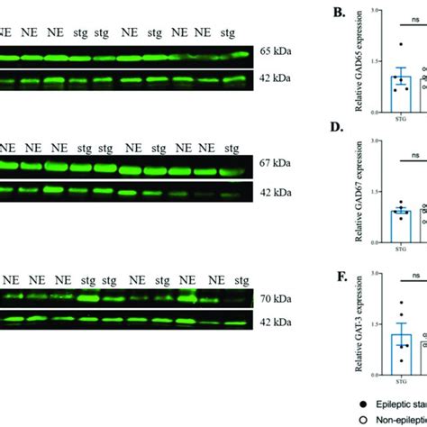 Western Blot Analysis Of Gad65 Gad67 And Gat 3 In The Cno Treated Download Scientific Diagram