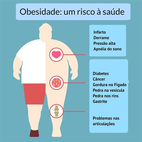 OBESIDADE