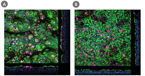 Icc Staining Protocol For Monolayer Or Air Liquid Interface Cultures Of