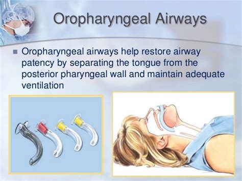 Advanced Airway Clearance