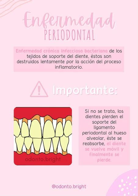 Enfermedad Periodontal Odonto Bright UDocz