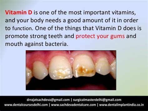 Why your teeth need vitamin d