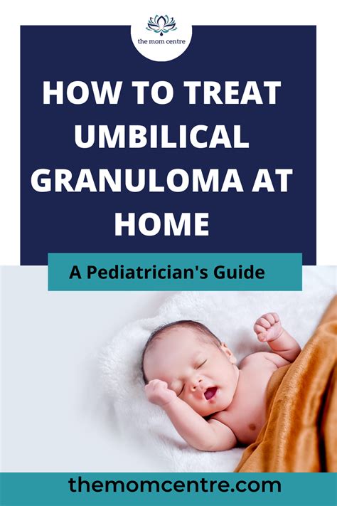 How to treat Umbilical Granuloma at home? - the mom centre