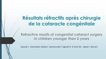 Cataracte ophtalmologie lariboisière