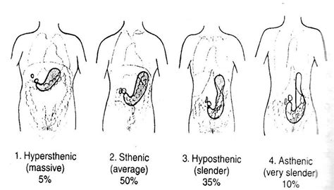 Twiss Blog Teknik Radiografi Omd Oesophagus Maag Duodenum