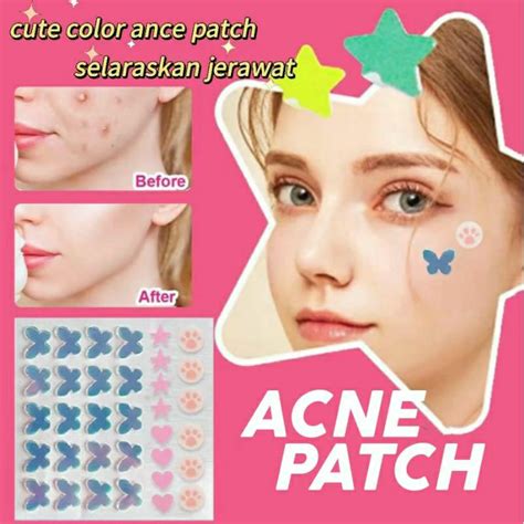 Jual Stiker Jerawat Hydrocolloid Acne Pimple Patch Colorful Acne