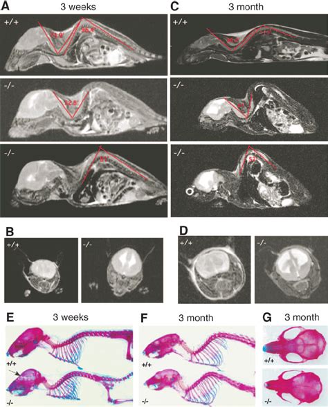 Mri And Skeletal Analysis Of Nfix Ϫ Ϫ Mice Sagittal A And C And