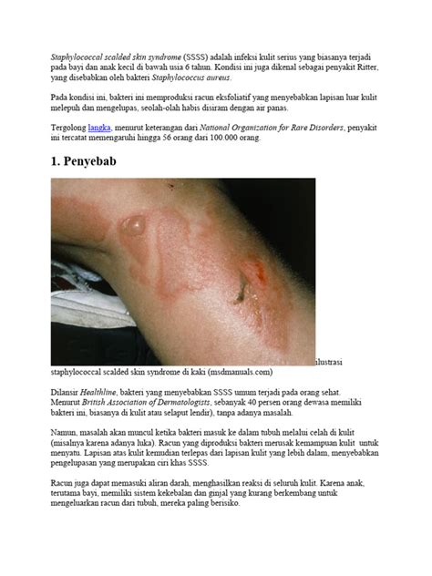 14 Staphylococcal Scalded Skin Syndrome Pdf