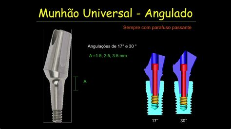 Vídeo 6 2 1 Instalação de cicatrizadores e Munhões Universais em