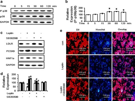 Leptin Modulates Ldlr And Pcsk Protein Levels And Ldl Uptake Through A