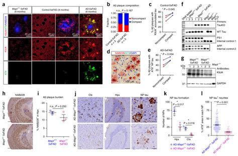 Amyloid β plaques enhance Alzheimers brain tau seeded pathologies by