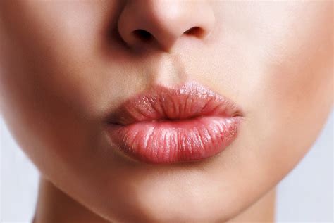 Preenchimento Labial Tire Todas Suas Dúvidas Trindade Odontologia