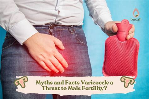 Myths And Facts Varicocele A Threat To Male Fertility