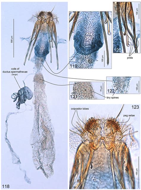 3 Female Genitalia Of Paratischeria Tubifex Diškus And Stonis Sp Nov Download Scientific