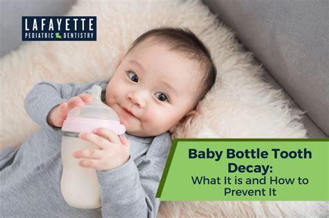 Baby Bottle Tooth Decay: What It is and How to Prevent It - Lafayette Pediatric Dentistry