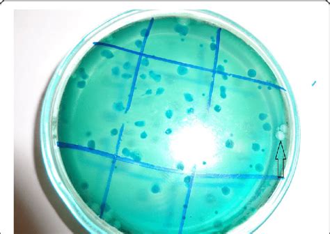 Bacillus Cereus Agar